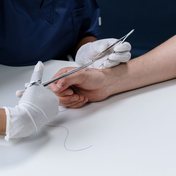 Retiro de puntos de sutura con instrumental estéril